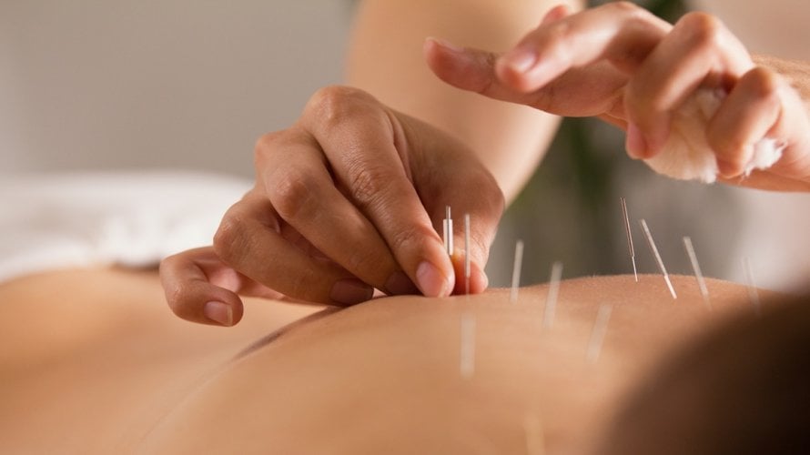 Pregled brojnih studija je potvrdio dugotrajan učinak akupunkture koji nije samo placebo