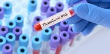 Test na trombofiliju