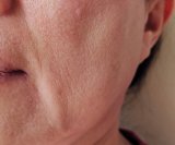 menopauza i suha usta