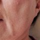 menopauza i suha usta