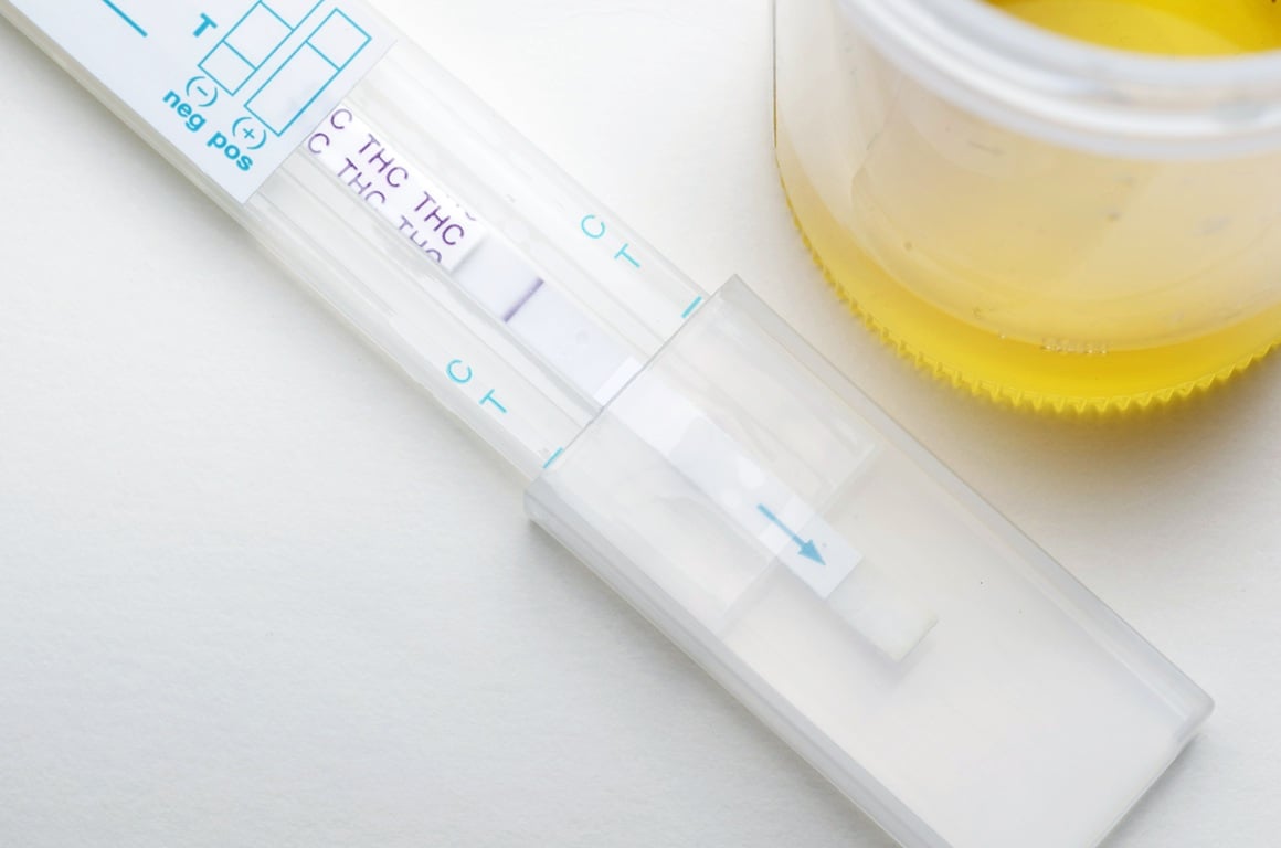 testiranje prisutnosti THC-a u urinu