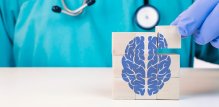 Alzheimerova bolest ne utječe samo na mozak