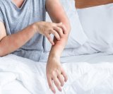 Devet uobičajenih okidača alergija koje trebate znati