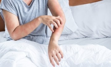 Devet uobičajenih okidača alergija koje trebate znati