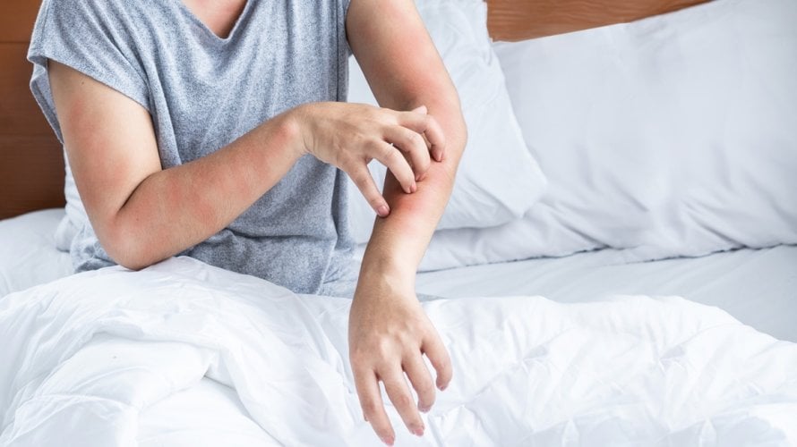 Devet uobičajenih okidača alergija koje trebate znati