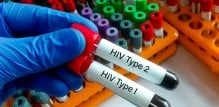 HIV-1 i HIV-2 - razlika