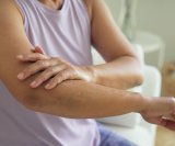 Kako se nositi s ekcemom u menopauzi Učinite ovo