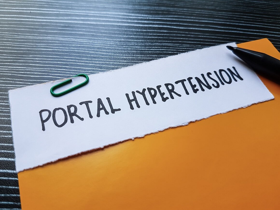 Portalna hipertenzija - dijagnoza