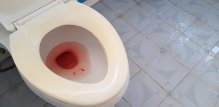 Prirodni lijek za krv u mokraći