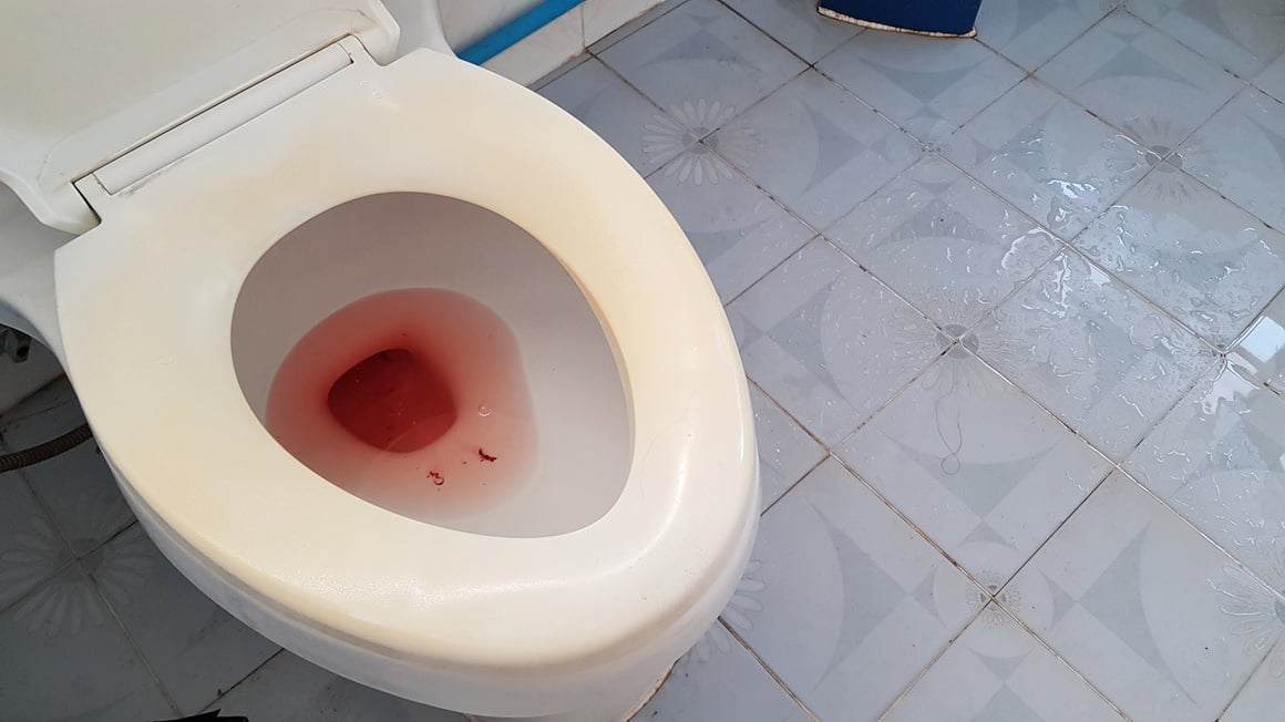 Prirodni lijek za krv u mokraći