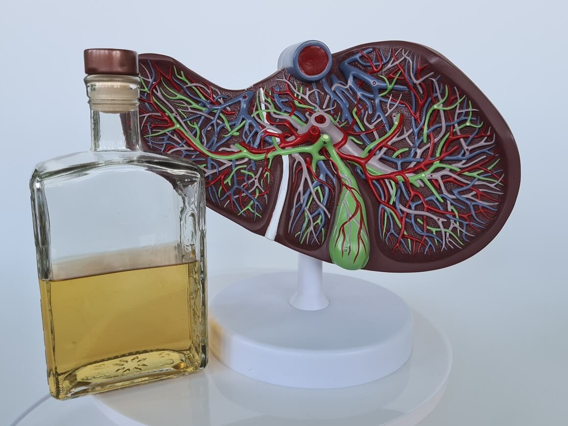 Alkohol povećava rizik od težih bolesti jetre