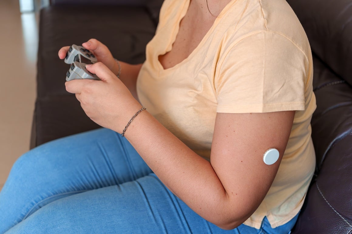 CGM (engl. Continuous Glucose Monitor) je mali senzor koji se pričvrsti na kožu i mjeri glukozu u međućelijskoj tekućini ispod površine kože, 24 sata dnevno