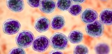 Epstein-Barr virus - posljedice
