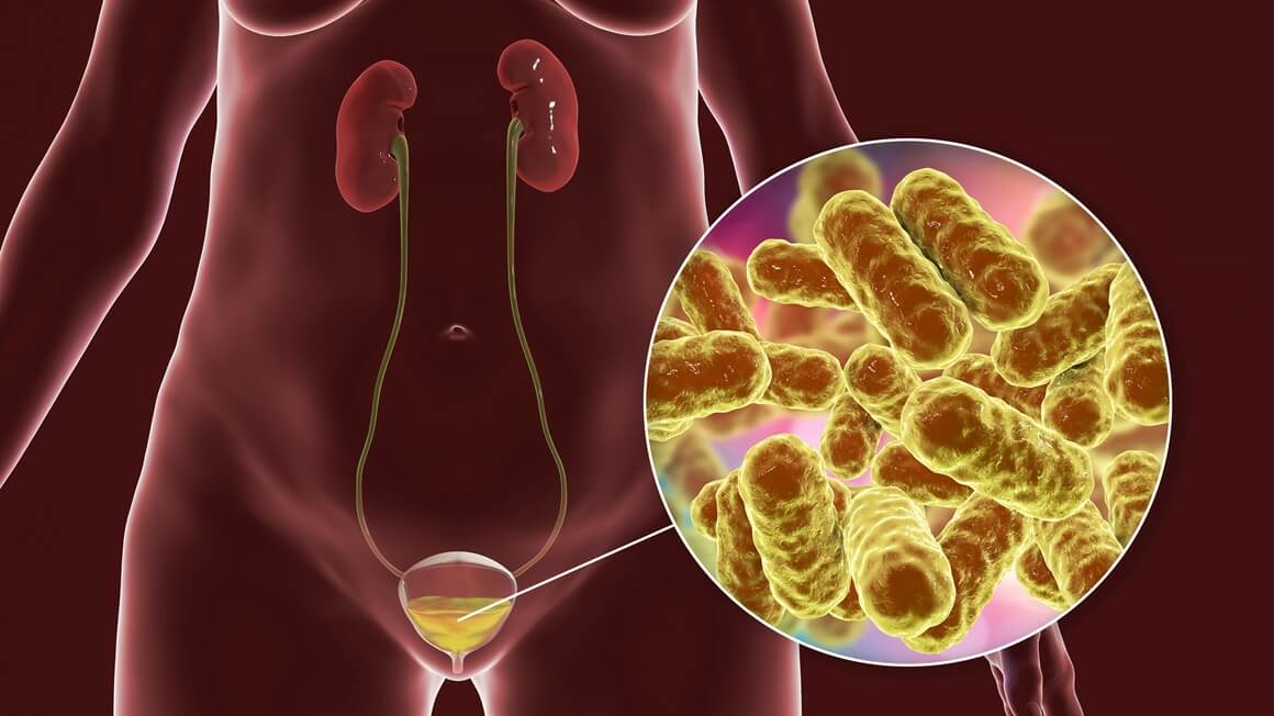 Escherichia coli u urinu - kako se prenosi