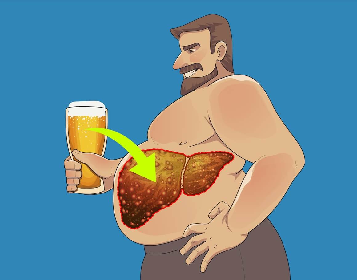 Masna jetra i alkohol