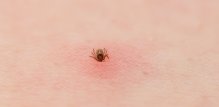 Sezona krpelja je u tijeku, a podaci pokazuju da bi ova godina mogla biti jedna od najgorih dosad