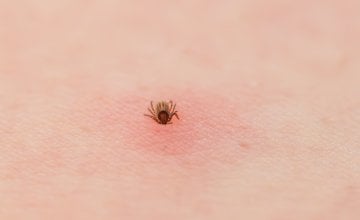 Sezona krpelja je u tijeku, a podaci pokazuju da bi ova godina mogla biti jedna od najgorih dosad
