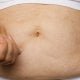 osobe koje koriste najčešće propisivane lijekove za mršavljenje u stvarnom životu ne gube toliko kilograma kao sudionici kliničkih ispitivanja