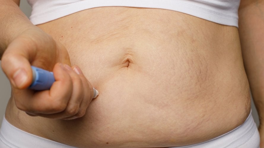 osobe koje koriste najčešće propisivane lijekove za mršavljenje u stvarnom životu ne gube toliko kilograma kao sudionici kliničkih ispitivanja