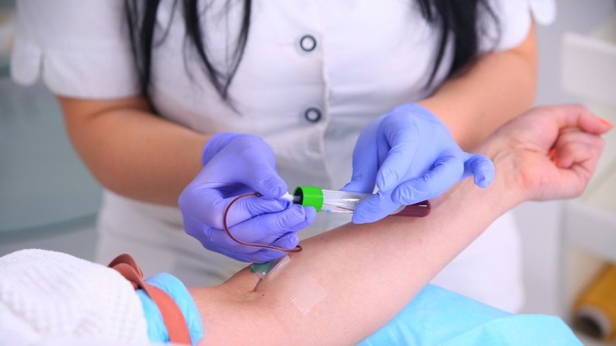 Ako ste na terapiji zbog hipotireoze, redovito testiranje razine hormona štitnjače postaje dio vaše rutine