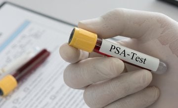 Normalan nivo PSA
