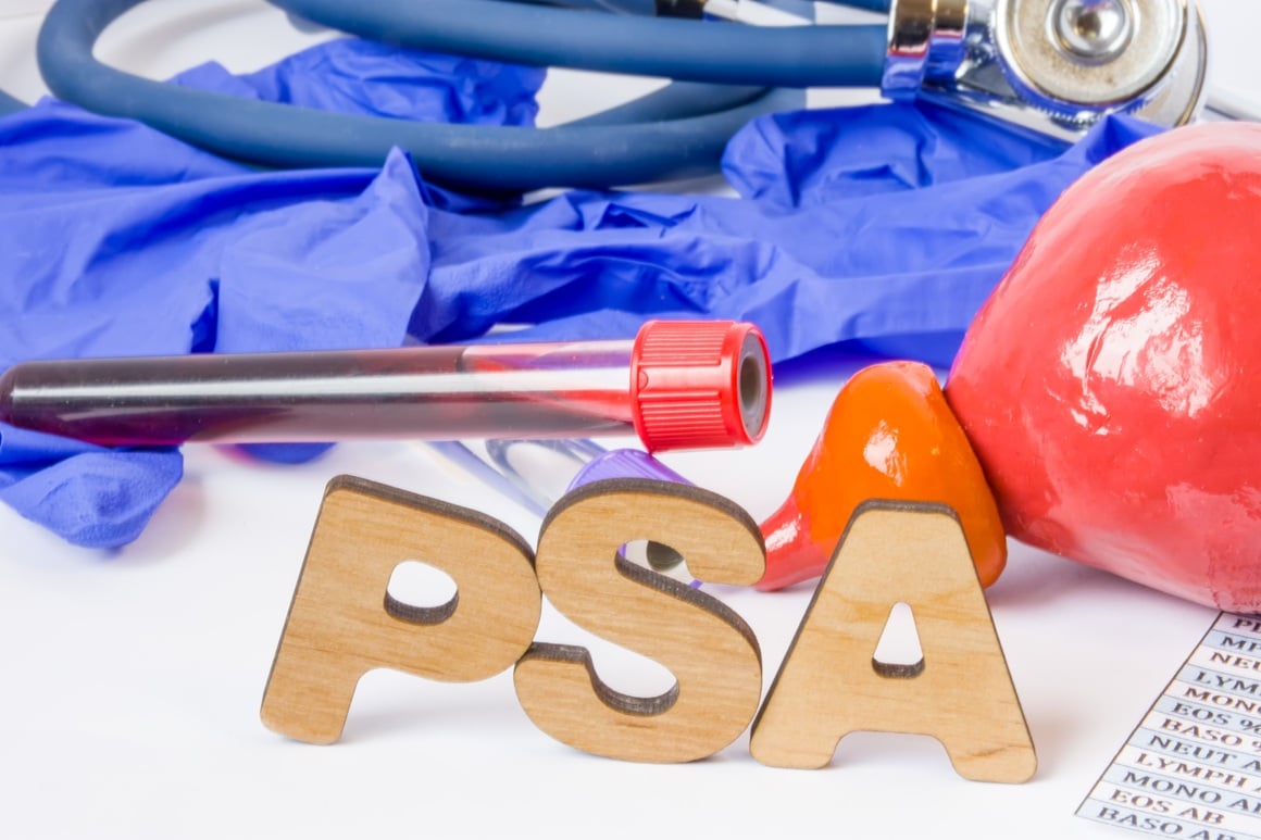 Prostata specifični antigen (PSA) je protein koji proizvodi tkivo prostate - male žlijezde veličine oraha smještene ispod mokraćnog mjehura i ispred rektuma kod muškaraca