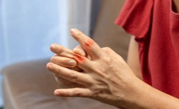 Reumatoidni artritis je kronična upalna bolest