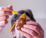 Kako provjeriti rad nadbubrežne žlijezde