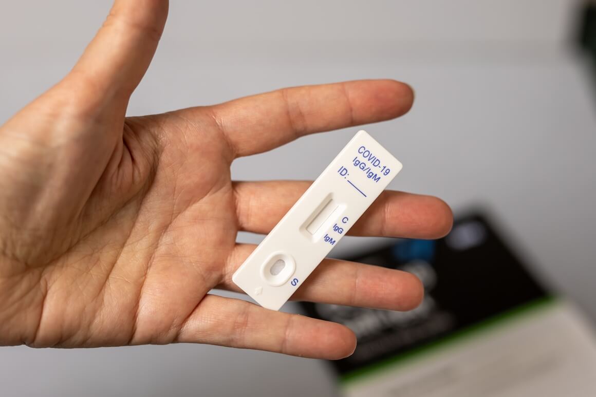 Korištenje COVID testova kojima je istekao rok trajanja nije preporučljivo
