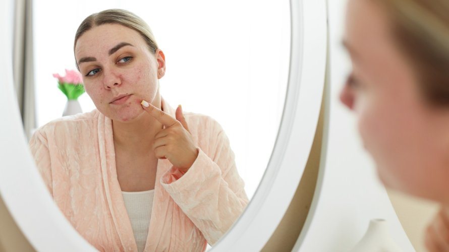 Stres, tjeskoba ili depresija mogu izazvati pogoršanje postojećih kožnih problema ili čak stvoriti nove