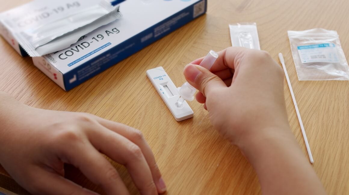 Testovi na COVID-19 imaju rok trajanja