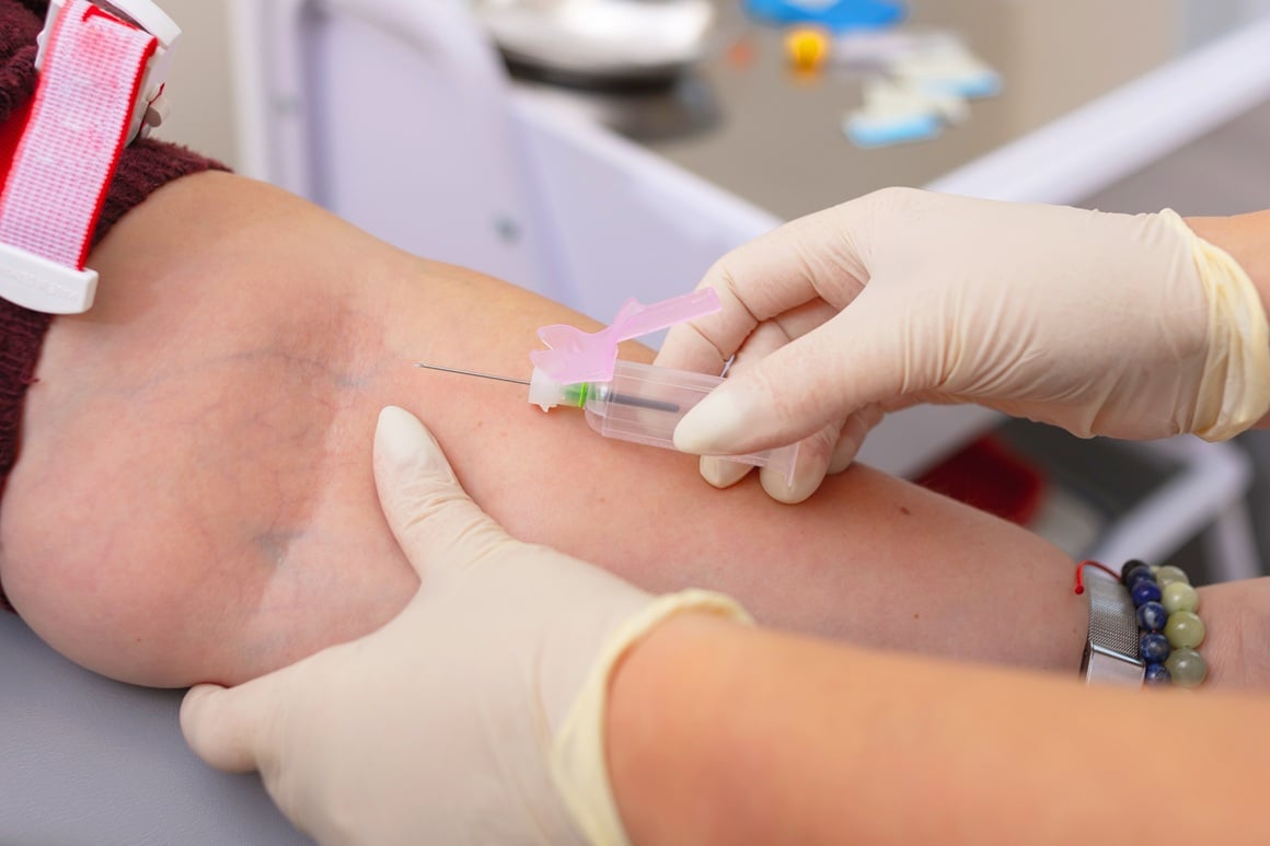 hormoni nadbubrežne žlijezde - laboratorij
