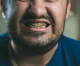 veći unos crvenog mesa je povezan s lošijim zdravljem desni