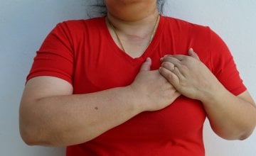 visceralna mast može ubrzati starenje srca i krvnih žila, neovisno o vašoj ukupnoj tjelesnoj težini