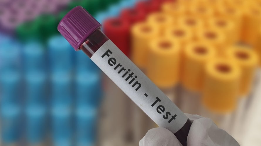 Feritin vrijednosti