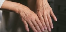 Kako koža postaje tanja, vene na rukama postaju izraženije