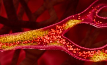 Kolesterol je često nevidljiv problem - ne boli, ne pokazuje se na prvi pogled, ali može ozbiljno ugroziti zdravlje srca i krvnih žila