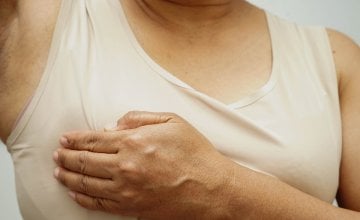 Lobularni karcinom dojke može zahvatiti svaku ženu, ali neke skupine su posebno izložene