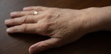 Starenje je prirodan proces koji ostavlja tragove i na našoj koži - a posebno na rukama