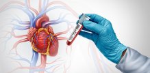 Testiranje na nasljedne bolesti srca