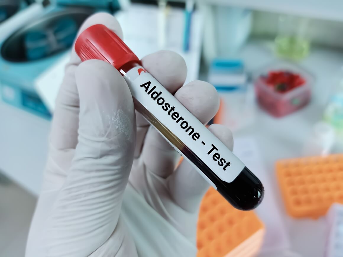 povišen aldosteron