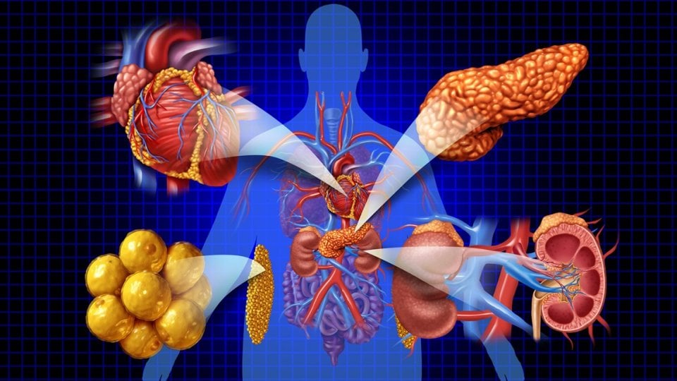 sindrom kardiovaskularno-bubrežno-metaboličkog sustava (CKM)