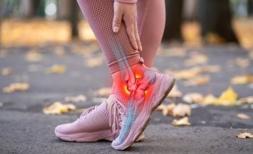 Ahilova tetiva spaja mišiće stražnje lože potkoljenice - gastrocnemius i soleus - s petnom kosti