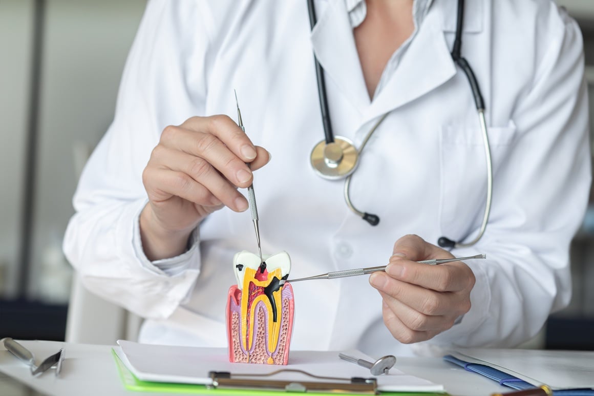 Bakterije iz zaraženih zuba mogu poremetiti metabolizam