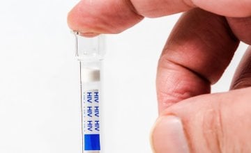 Brzi test na HIV u apotekama