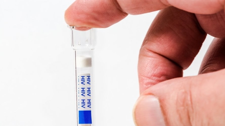 Brzi test na HIV u apotekama