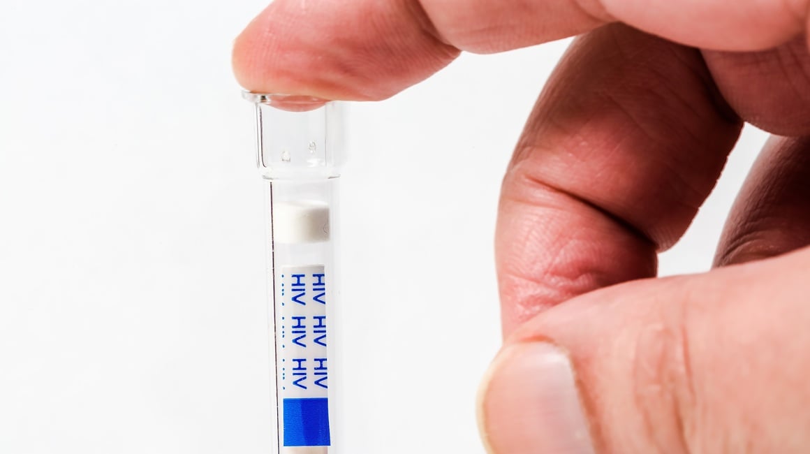 Brzi test na HIV u apotekama
