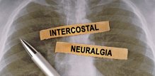 Interkostalna neuralgija - liječenje