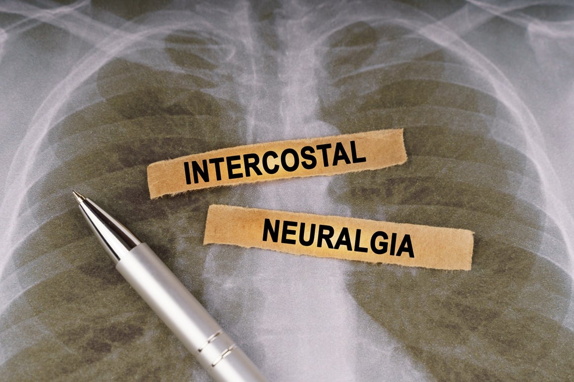 Interkostalna neuralgija - liječenje