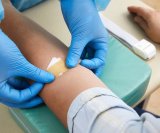 Lipoprotein (a) i kolesterol